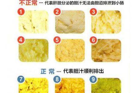 宝宝拉屎有奶瓣