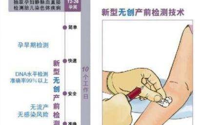 无创dna是检查什么的