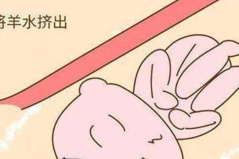 分娩知识