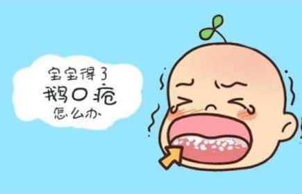 宝宝鹅口疮