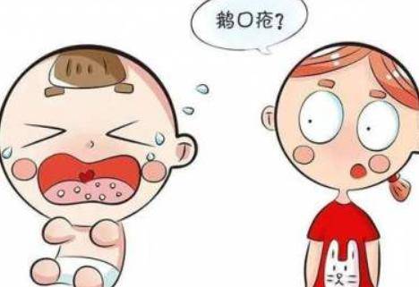 宝宝鹅口疮