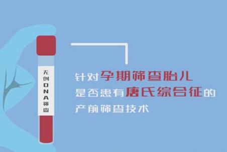 唐氏综合征