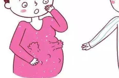 孕妇注意事项