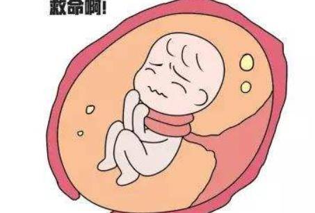 脐带绕颈