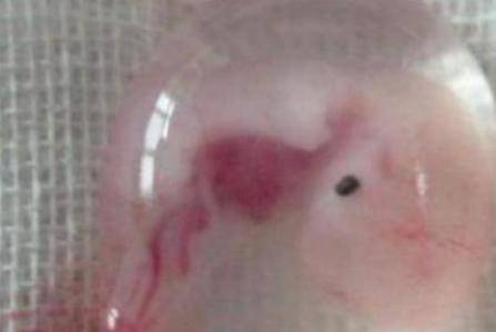 胎停育的原因