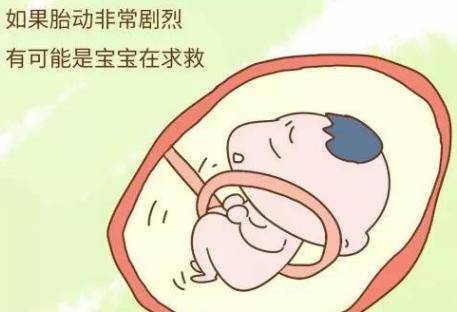 脐带绕颈