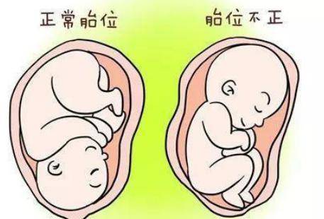 分娩方式