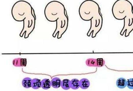 nt检查