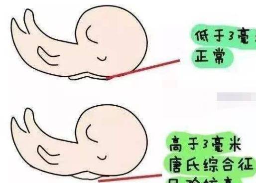 nt检查