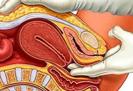 顺产过程