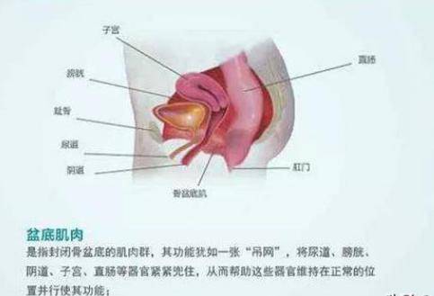 盆底肌修复