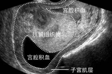 恶露是什么