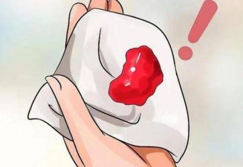 恶露是什么