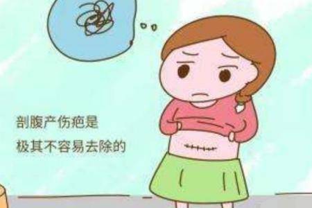 顺产好还是剖腹产好