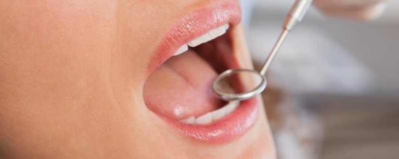 自己单独去医院做个口腔活检可以吗？
