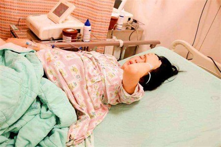 1567568323655444.jpg 剖腹产